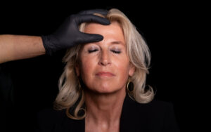 Natuurlijk en subtiel resultaat met Baby Botox bij Kliniek Vinci in Leiden