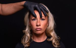 botox frons rimpel behandelen met botox