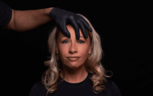 botox frons fronsrimpel