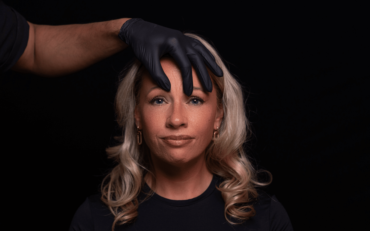 botox frons fronsrimpel