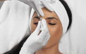 botox touch up