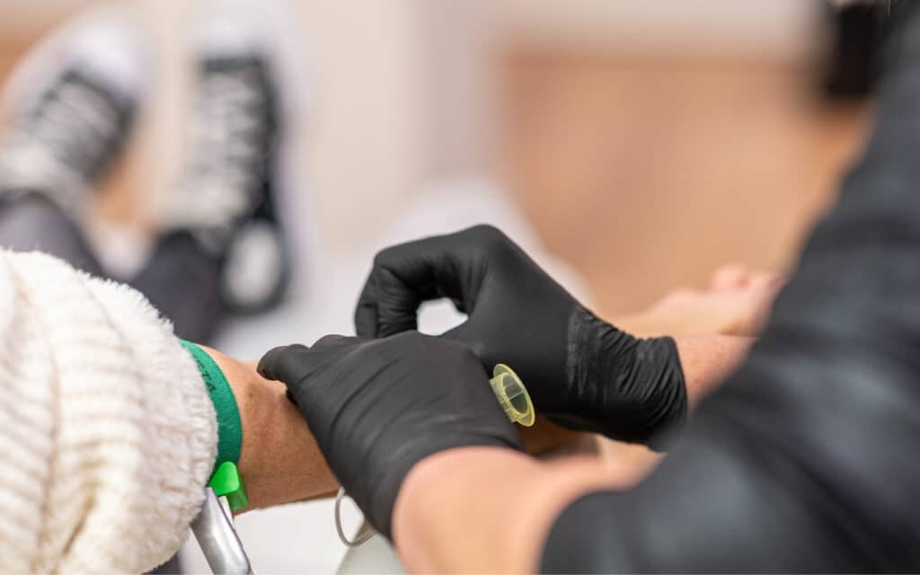 PRP behandeling