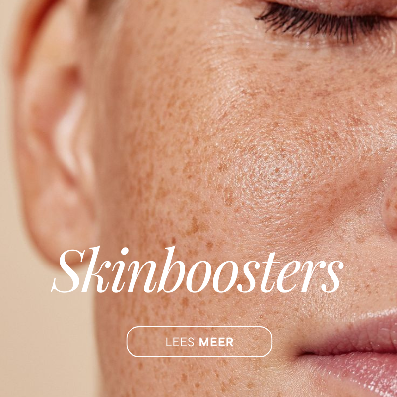 Skinboosters