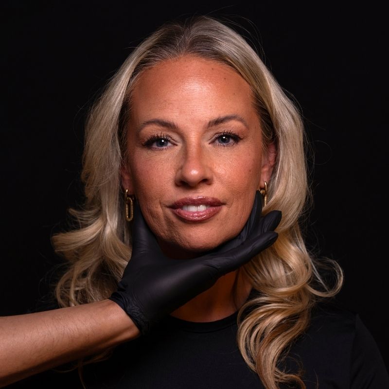 Model met een natuurlijk en fris resultaat na een botox behandeling bij Kliniek Vinci in Leiden